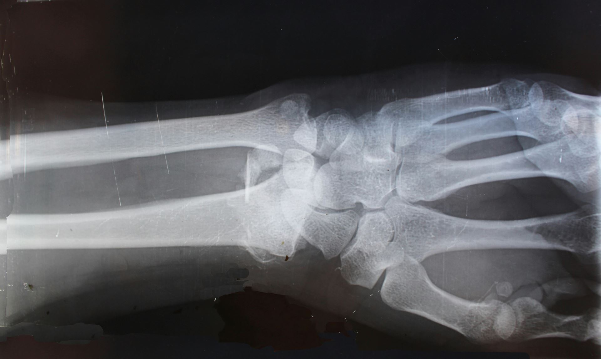 x-ray image